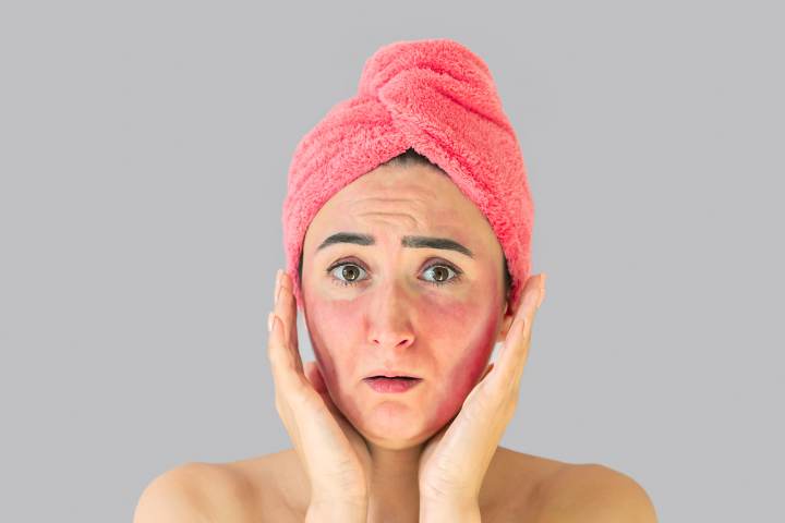 Globuli Stress Hautausschlag behandeln lernen
